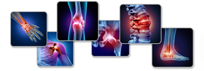Collage of medical illustrations showing highlighted joints including hand, knee, hip, spine, and ankle on dark backgrounds